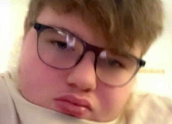 Un tânăr de 17 ani, care a fost declarat decedat de poliție în urma unui accident, a „înviat“ la spital