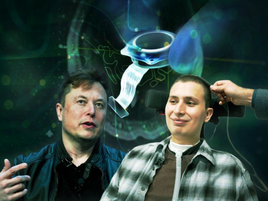 Primul pacient cu cipul cerebral implantat, al lui Elon Musk: „Se simte magic“