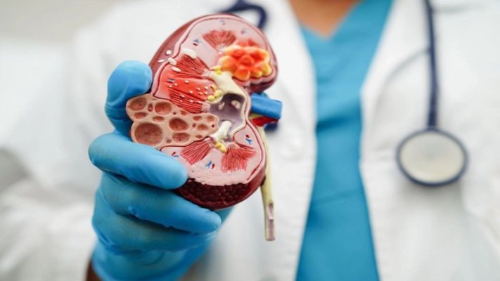 Remedii naturale: Plantele care ajută rinichii să elimine toxinele și reduce retenția de apă