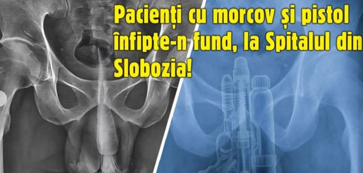 Amor periculos! Un polițist și un angajat SRI au ajuns la spital cu... jucării înfipte în fund: un pistol și un morcov