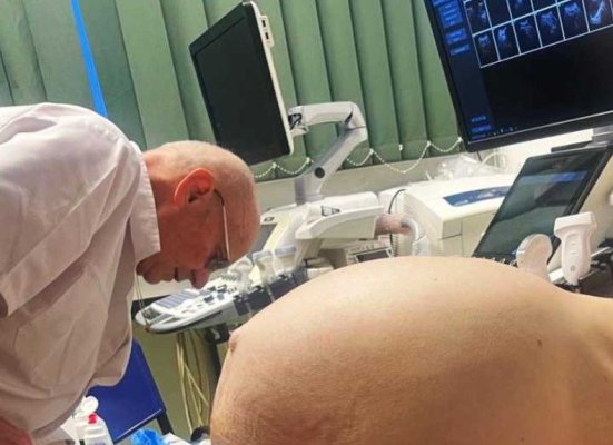 Tumoare gigant de 25 de kilograme, extirpată prin operație la Spitalul Județean Cluj de la un pacient de 71 de ani