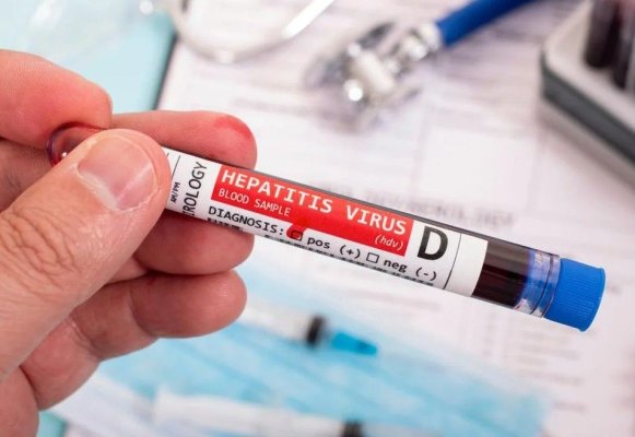 Premieră medicală la Beijing - primul tratament cu anticorpi monoclonali împotriva hepatitei D