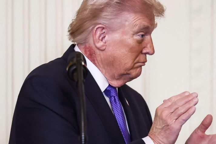 Imagine alarmanta cu Donald Trump: a aparut in public cu ceea ce pare a fi o rana rosie la gat
