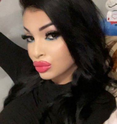 Ea este tânăra de 21 de ani care a ajuns în stare gravă la spital, după ce a intrat cu mașina în pom, la Amzacea