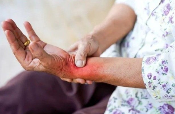 Inflamația cronică, „epidemia tăcută“ care afectează sănătatea fizică și mintală