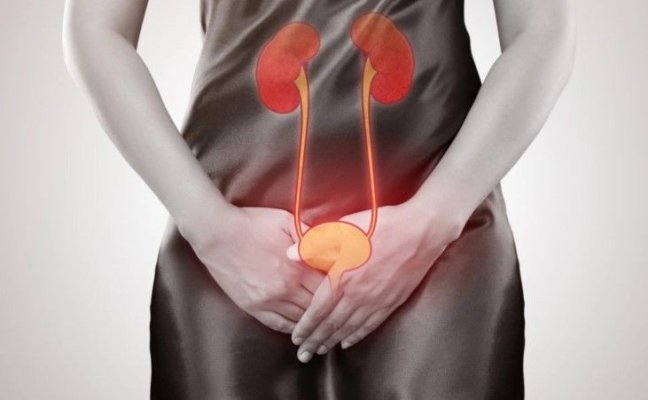 Incontinenţa urinară în stadiu incipient sau moderat, tratabilă cu ajutorul unui fotoliu care stimulează musculatura planşeului pelvin