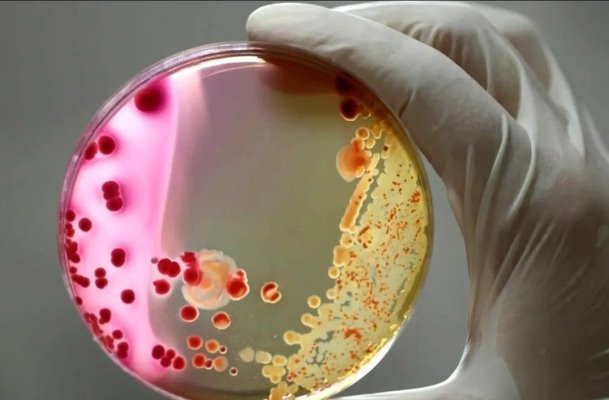 A fost înregistrată prima transmitere de la om la om a bacteriei dermatofilozei