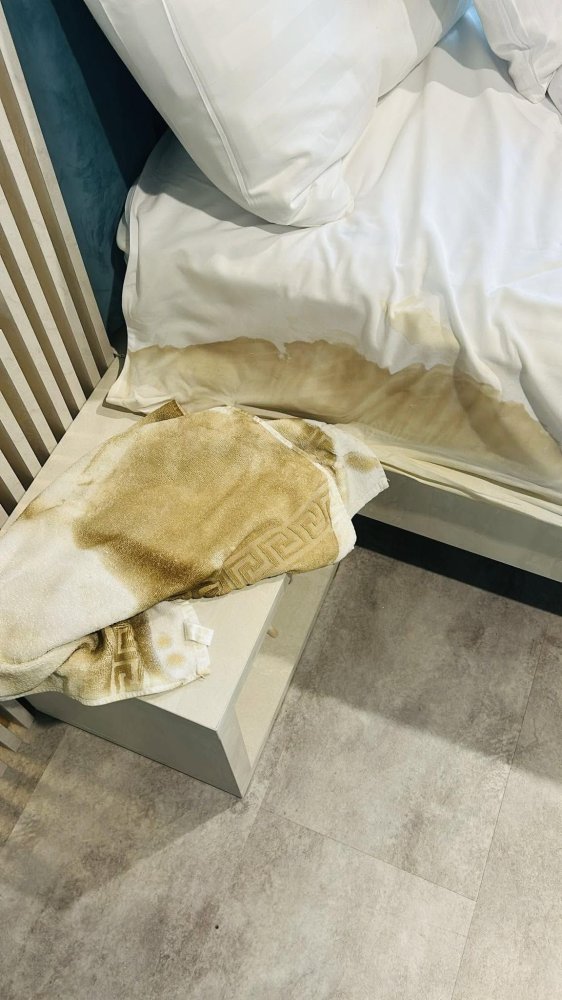 La hotel Marea Neagra din Mamaia... decat sa folosesti prosoapele... mai bine te stergi cu hartie igienica... ca sa nu ramai fara bani La hotel Marea Neagra din Mamaia... decat sa folosesti prosoapele... mai bine te stergi cu hartie igienica... ca sa nu ramai fara bani