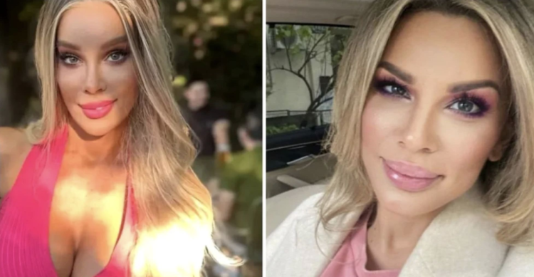 Alina Laufer, pusă la zid după ce și-a operat fața: „Comentariile au fost deplasate”