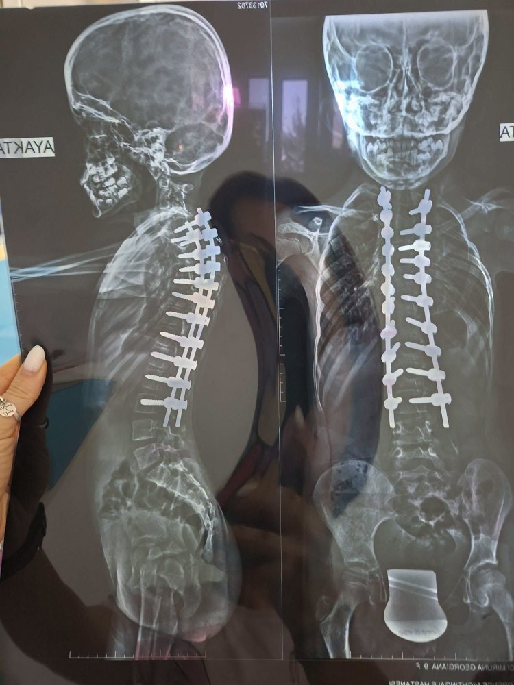 Preotul din Viorel Popa, din Topraisar, striga dupa ajutor pentru o fetita de 10 ani diagnosticata cu o boala grava la coloana Preotul din Viorel Popa, din Topraisar, striga dupa ajutor pentru o fetita de 10 ani diagnosticata cu o boala grava la coloana