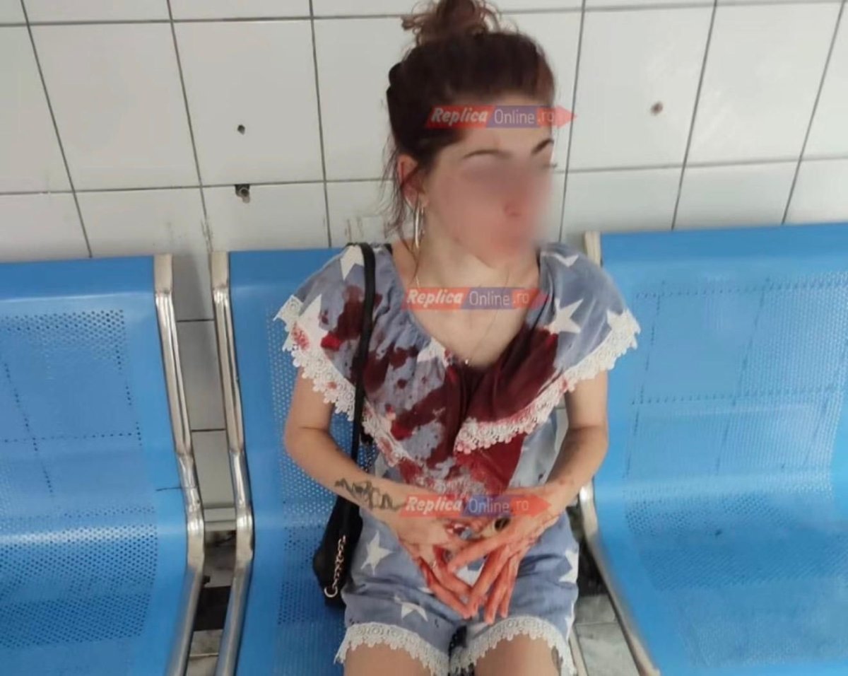 Agresiune de o cruzime rara in Medgidia! O tanara de 22 de ani, desfigurata cu o rozeta din cauza unui baiat: „Mi-au spus ca ma omoara daca merg la politie” Agresiune de o cruzime rara in Medgidia! O tanara de 22 de ani, desfigurata cu o rozeta din cauza unui baiat: „Mi-au spus ca ma omoara daca merg la politie”