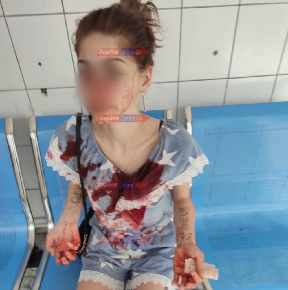 Agresiune de o cruzime rara in Medgidia! O tanara de 22 de ani, desfigurata cu o rozeta din cauza unui baiat: „Mi-au spus ca ma omoara daca merg la politie” Agresiune de o cruzime rara in Medgidia! O tanara de 22 de ani, desfigurata cu o rozeta din cauza unui baiat: „Mi-au spus ca ma omoara daca merg la politie”