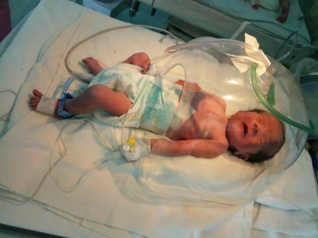 Strigăt de AJUTOR al unui nou-născut: operat de două ori, într-o săptămână de la venirea pe lume!