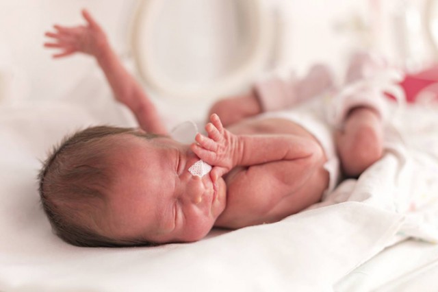 Firmele pot dona 20% din impozitul pe profit pentru a salva nou-născuţii prematuri