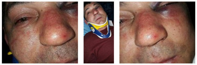 Măsuri în cazul bărbatului agresat și ascuns în pod, la Năvodari