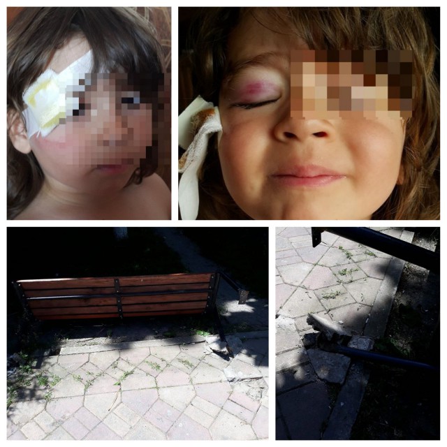 Copil RĂNIT în parc, la Murfatlar: A CĂZUT O BANCĂ PESTE EL!