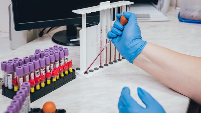 O singură doză de vaccin anti-HPV oferă protecție împotriva cancerului de col uterin