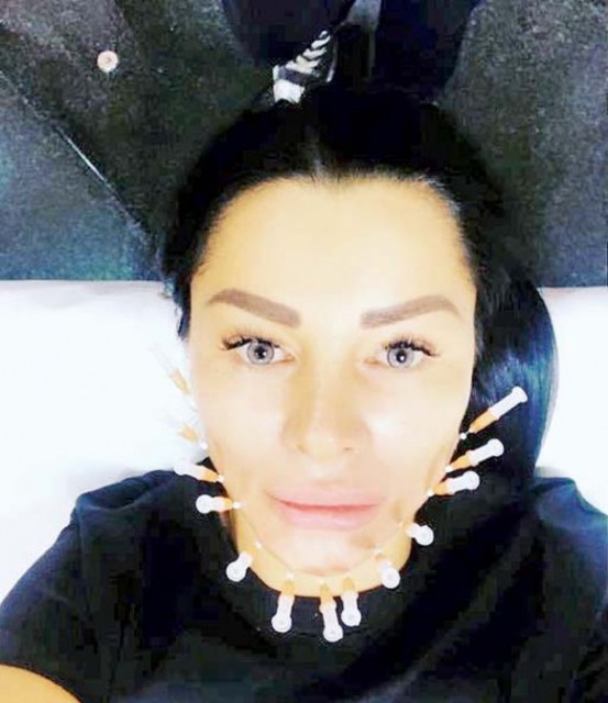 Brigitte Năstase, obsedată de tinereţe „Am cheltuit 30.000 de euro doar pentru faţa mea”