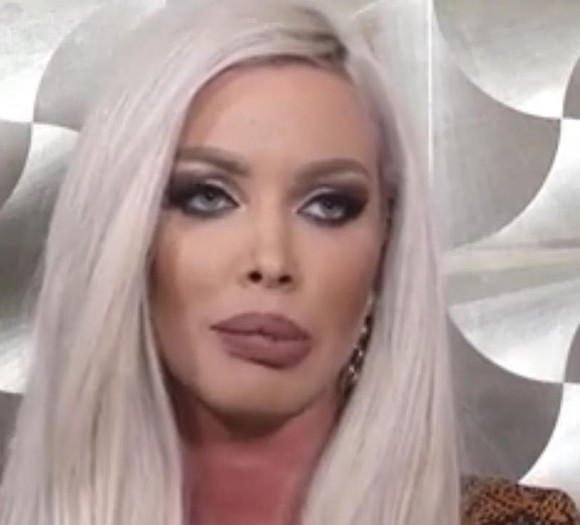 Loredana Chivu, accident la estetician? Cum arată buzele ei