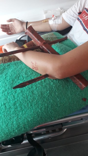 Intervenție la Constanța: Minoră cu mâna STRĂPUNSĂ de o bucată dintr-un gard