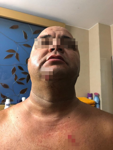 Avocatul bărbatului înjunghiat într-un club din Mamaia: Am informaţii că apropiaţii agresorilor plănuiau să incendieze maşinile clientului meu!
