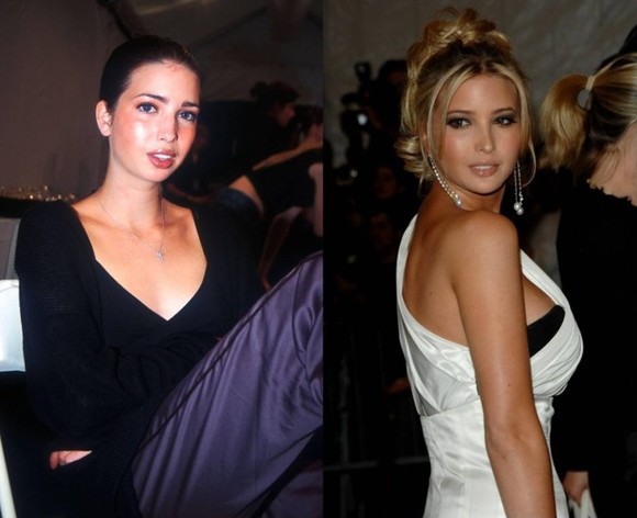 Ivanka Trump, operaţiile estetice la care a apelat