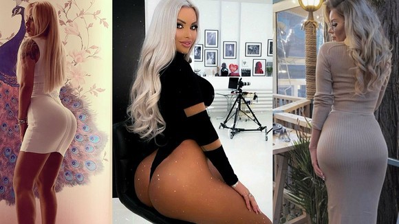 Fundurile de 17.000 de euro! Loredana Chivu și-a mărit din nou posteriorul, iar rezultatul este șocant