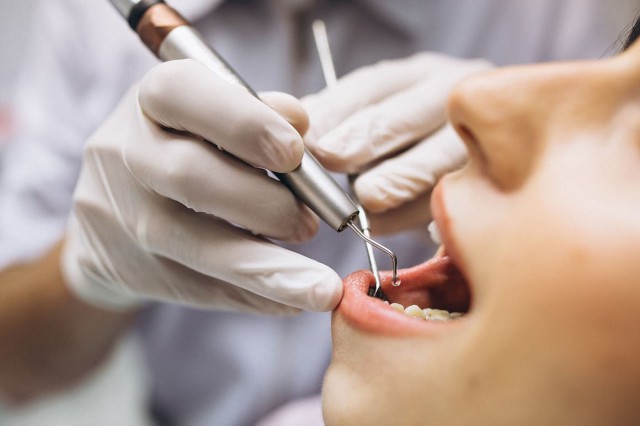 Anestezia dentară: tipuri, avantaje, riscuri, contraindicații
