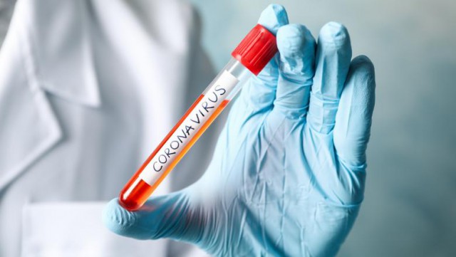 România are 50.000 de teste pentru coronavirus