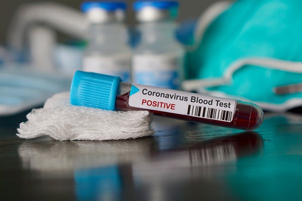 Numărul cazurilor de coronavirus a crescut cu 18,9% în săptămâna 6-12 aprilie faţă de cea precedentă