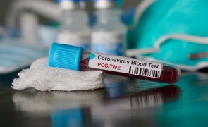 Primul deces cauzat de coronavirus în Republica Moldova