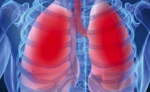 Medicii avertizează: 'Plămânul se poate strânge ca o smochină'