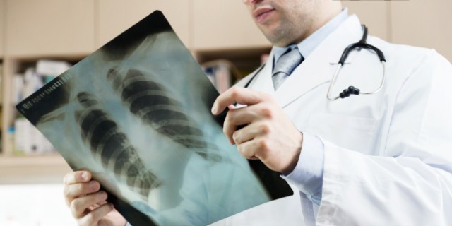Ce trebuie să faci pentru a avea plămâni puternici