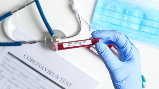 GCS: 326 de persoane - reconfirmate pozitiv cu COVID-19. 17 cazuri la Constanța