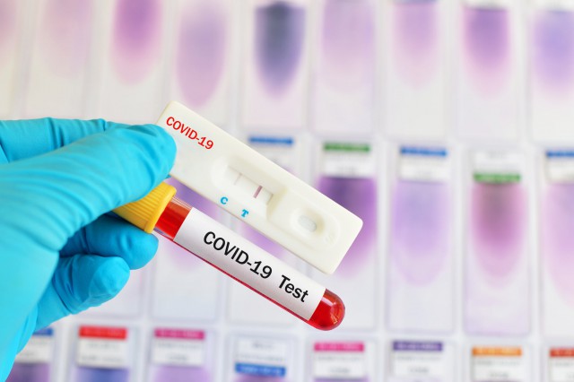 GCS: Numărul românilor din diaspora confirmaţi ca infectaţi cu noul coronavirus rămâne acelaşi - 3.393