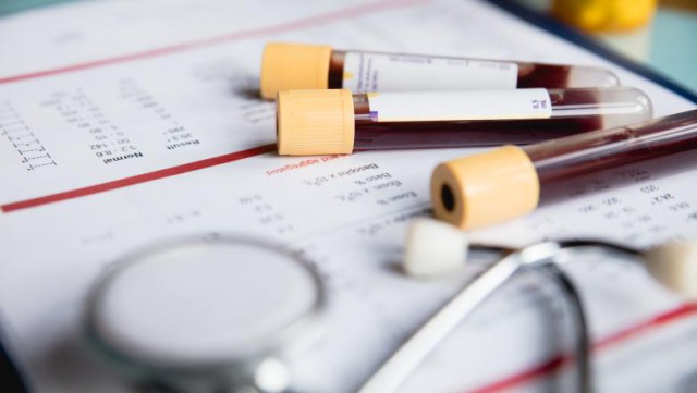 Nu amâna analizele de sânge, un indicator al stării tale de sănătate