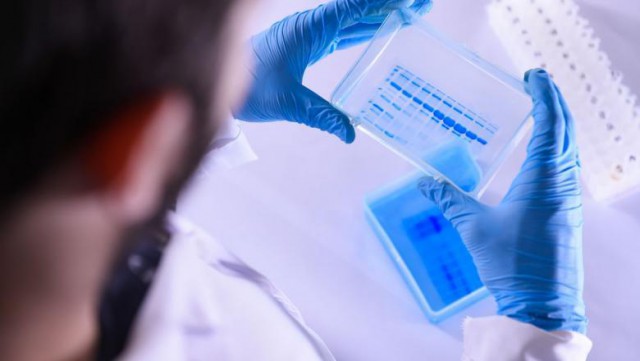 OMS: Să se retesteze pneumoniile suspecte de la finalul lui 2019! Manager „V. Babeș“: Era sezon gripal, posibil să fi circulat și COVID