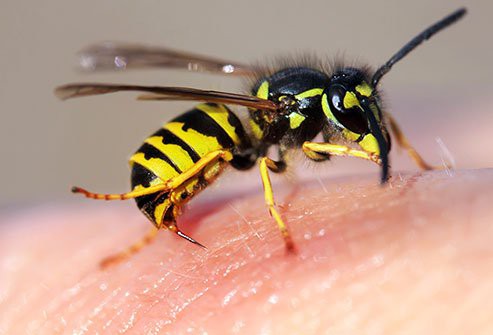 Cum recunoaștem alergia la înțepătura de insecte?