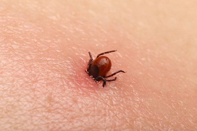 Boala Lyme – prevenție, simptome și tratament