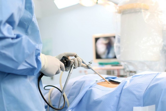 Totul despre chirurgia laparoscopică