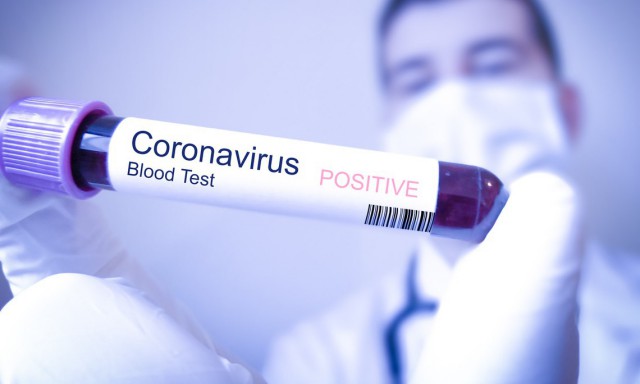 GCS: 3.074 de români din străinătate - confirmaţi ca fiind infectaţi cu noul coronavirus