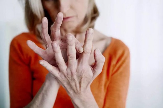 Poliartrita reumatoidă – Cauze, simptome, diagnostic, tratament