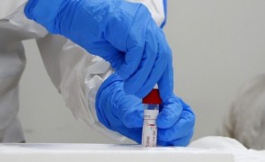 Cum se va desfășura testarea națională pentru stabilirea gradului de imunizare la COVID