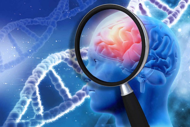Alzheimer: au microbii un rol esențial în dezvoltarea bolii?