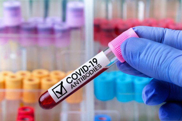 Studiu: Anticorpii anti-SARS-CoV-2 dispar după 2-3 luni de la infectare