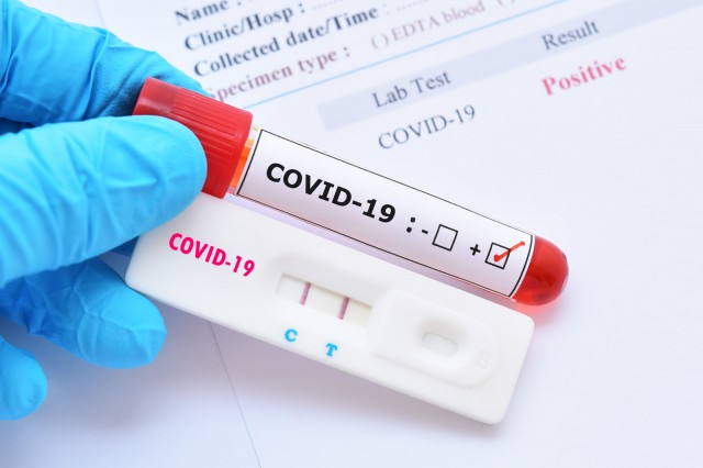 COVID-19: 1.309 cazuri noi în România, 30 la Constanţa!