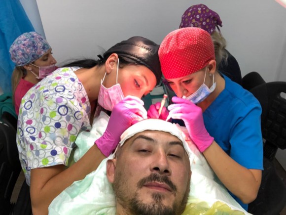Stefan Stan și-a făcut implant de păr la o clinică din Cluj. Iată rezultatul!