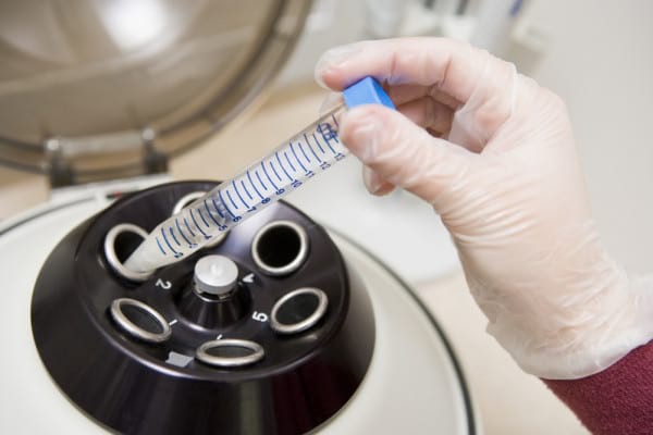 Analize pentru diagnosticarea infertilității la bărbați