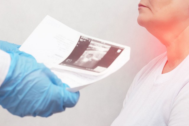 Studiu: Numărul cazurilor de cancer tiroidian a crescut la nivel mondial