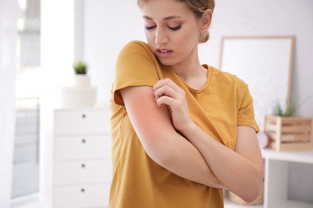 Studiu: Cauza reală a dermatitei atopice, mai aproape de a fi descoperită